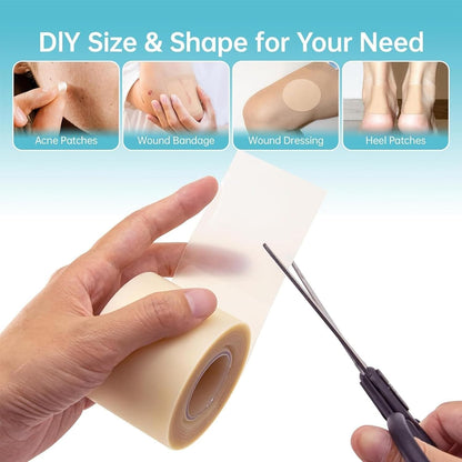 Acne Tape Roll
